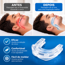 Aparelho Anti-Ronco para Dormir