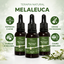 Óleo Essencial De Melaleuca 100% Puro 30ml Contra Micose Acne