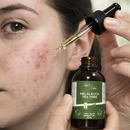 Óleo Essencial De Melaleuca 100% Puro 30ml Contra Micose Acne
